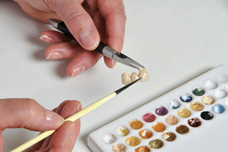 Jede Krone ist ein Unikat