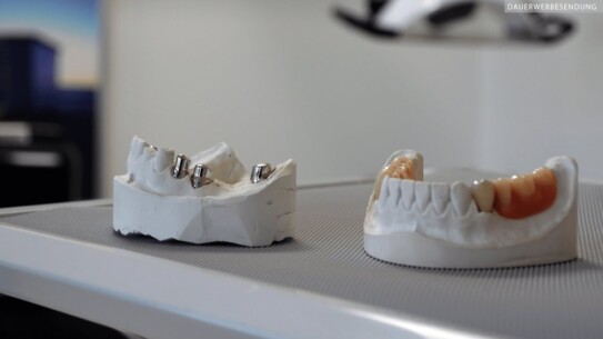 Zahnkronen mit Teleskoptechnik